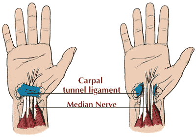 Diagram of human hand, showing the carpal tunnel ligament and median nerve