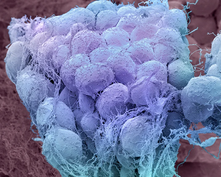 Microscopic image of fat tissue