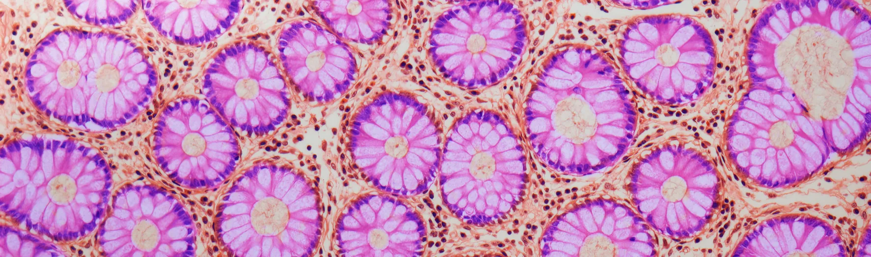 Microscopic image of lieberkuhn